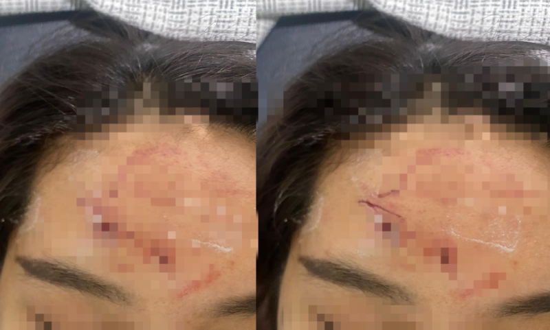 Korban penganiayaan saat menunjukkan luka yang dialaminya.